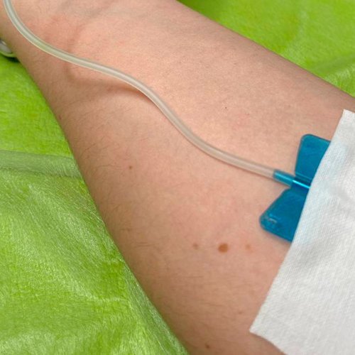 Внутривенное капельное вливание